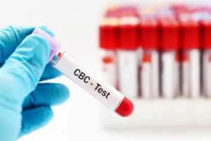 Cbc Test