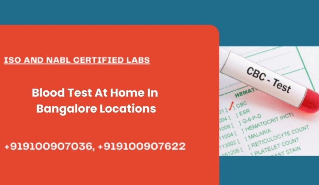 Blood Test In Bangalore Locations