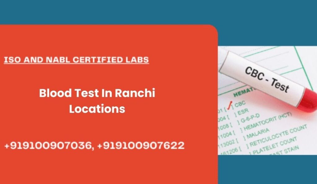 Blood Test In Ranchi Locations