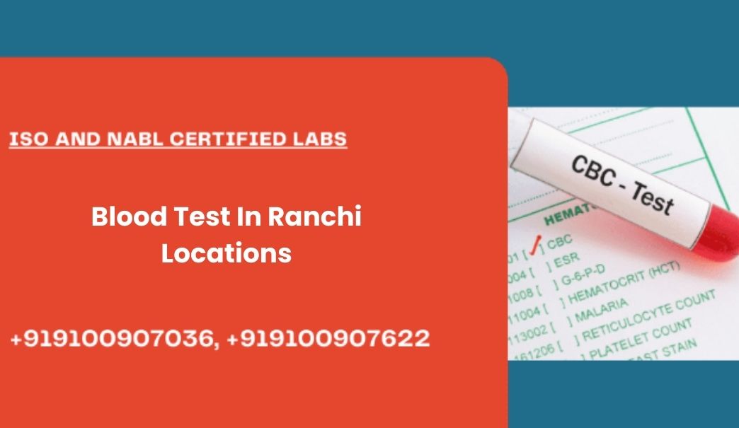 Blood Test In Ranchi Locations