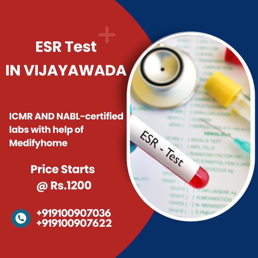ESR test in Vijayawada