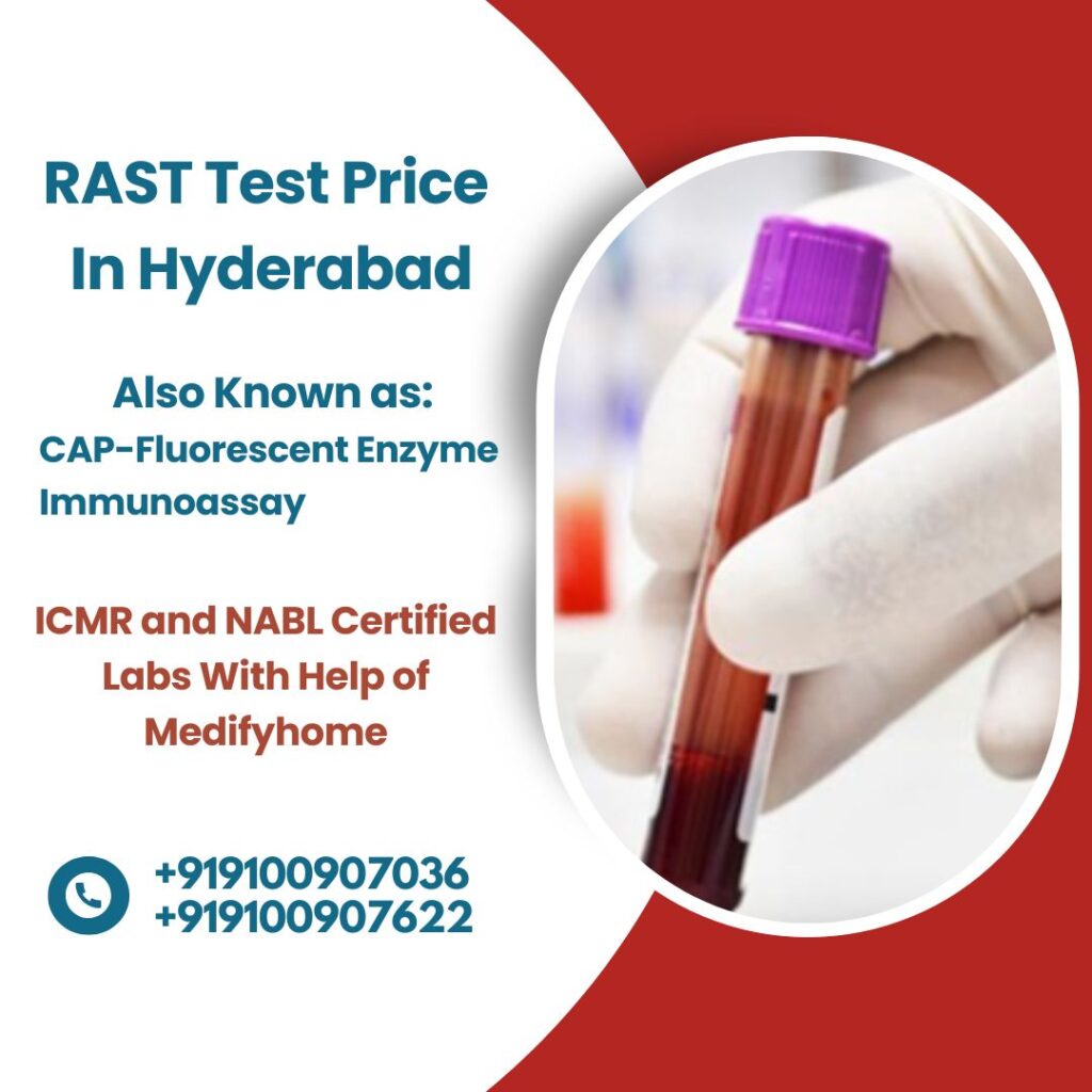 RAST test at home in Hyderabad
