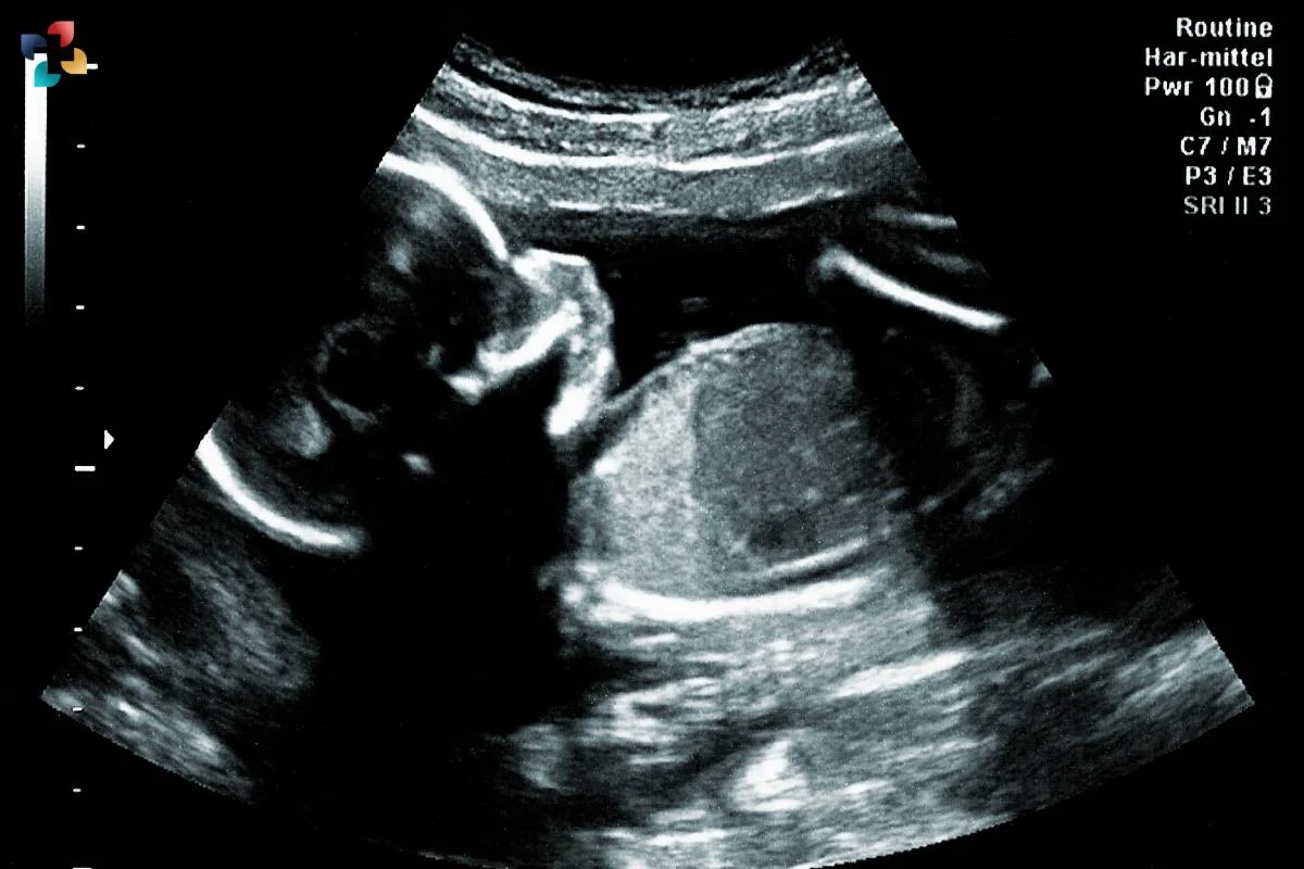 Ultrasound Scan For Biophysical Profile