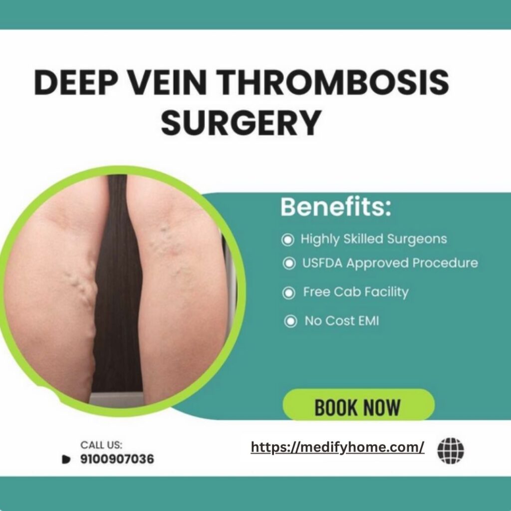 Deep vein Thrombosis