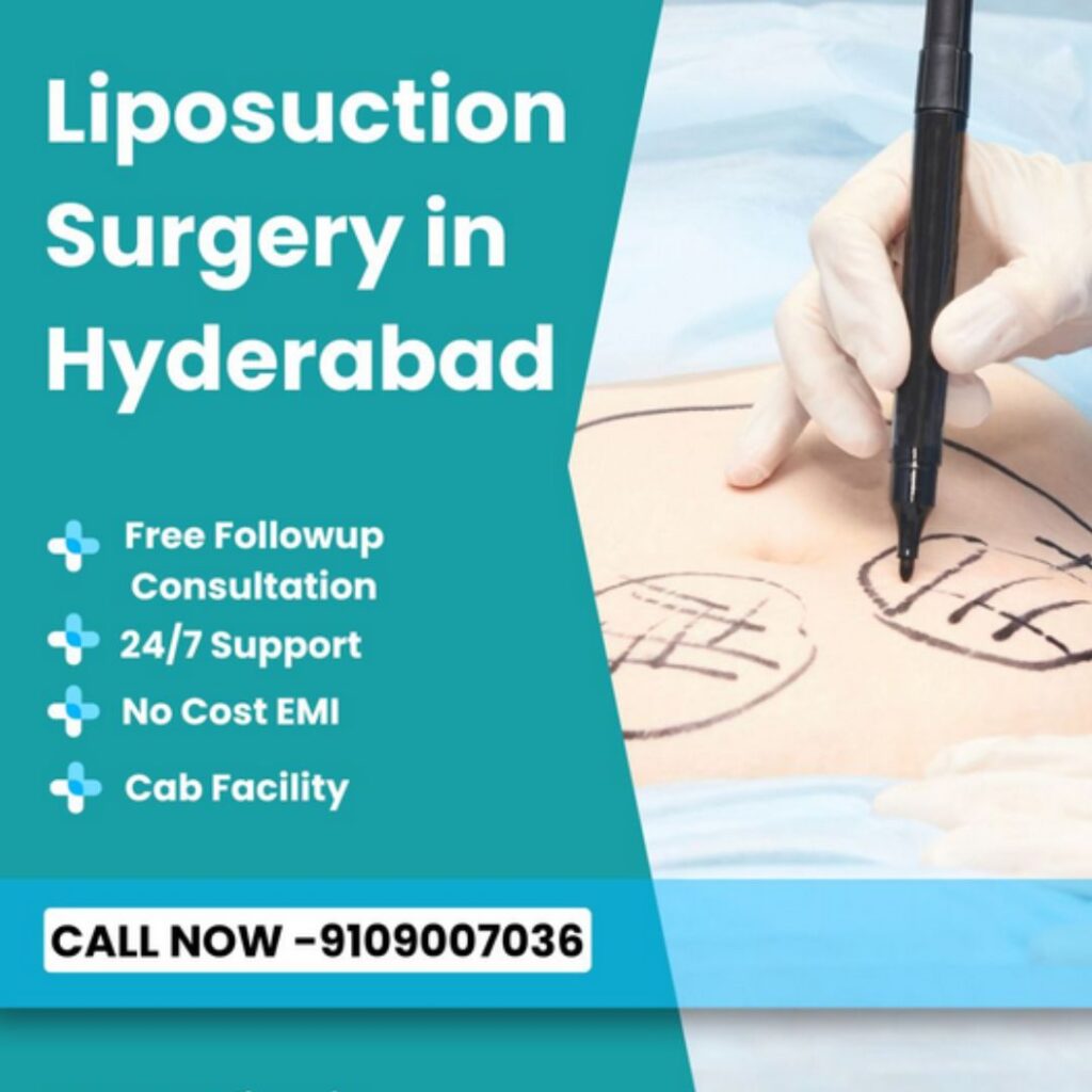 Liposuction Surgery in Hyderabad