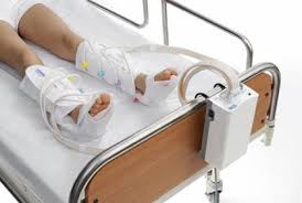 Sequential Compression Device (SCD)