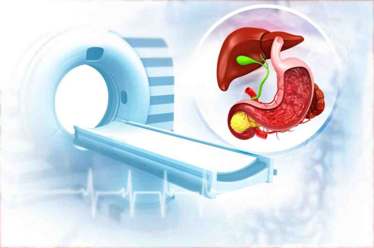 Abdominal CT Scan