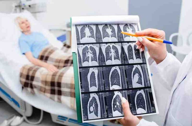 Chest CT Scan