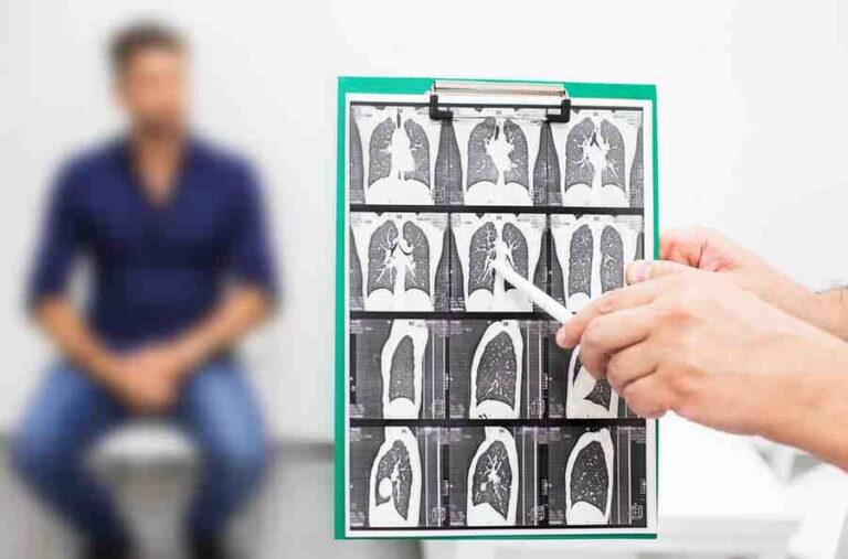 HRCT scan