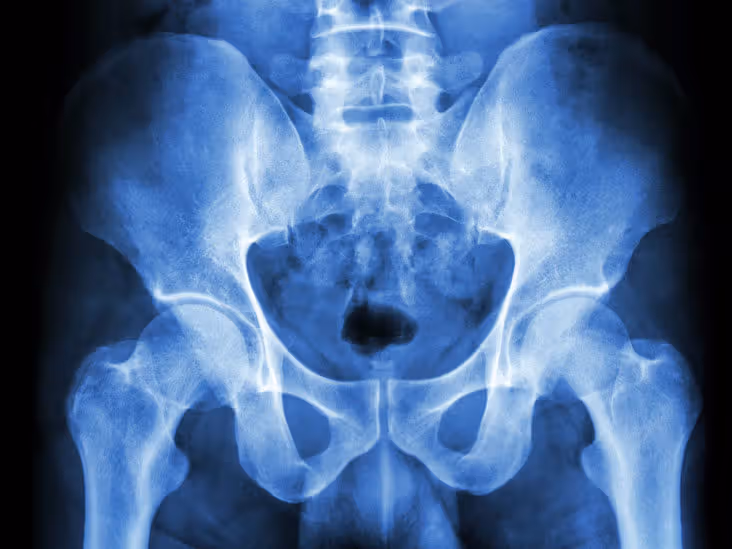 Pelvic MRI Scan