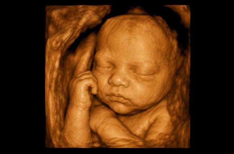 3D-Ultrasound-Scan
