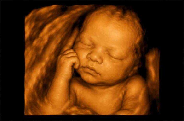 4d-scan