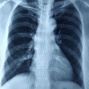 chest
