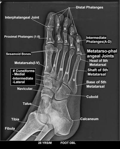 Foot X-Ray