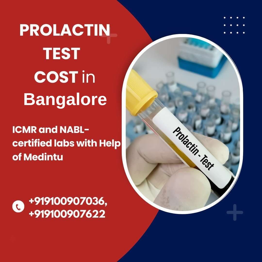 Prolactin Test at Home in Bangalore | Medifyhome