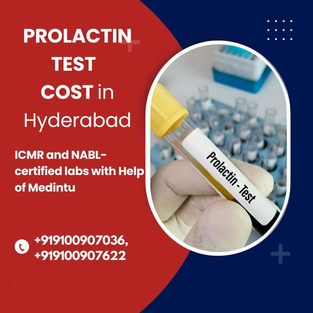 Prolactin Test at Home in Hyderabad | Medifyhome
