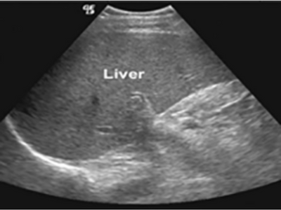 Liver